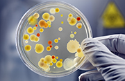La resistència antimicrobiana i el projecte SAFE (Superbug Awareness For Education)